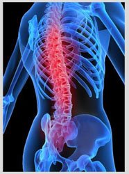 What are Benefits of Laser Spine Surgery