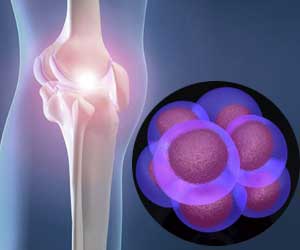 What is Stem Cell Therapy